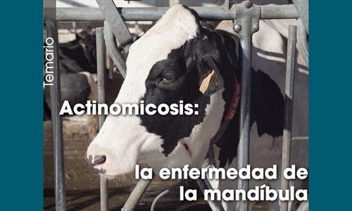 Actinomicosis: la enfermedad de la mandbula