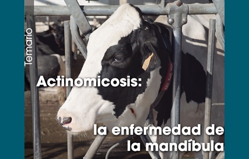 Actinomicosis: la enfermedad de la mandbula