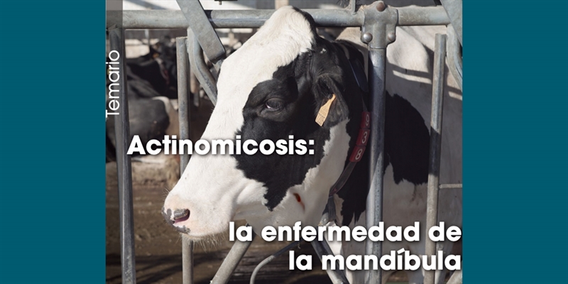 Actinomicosis: la enfermedad de la mandbula