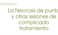 La Necrosis de punta y otras lesiones de complicado tratamiento