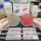 C�mo interpretar los resultados de los an�lisis microbiol�gicos (1)