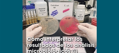 C�mo interpretar los resultados de los an�lisis microbiol�gicos (1)